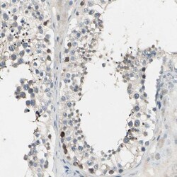 MSS4 Antibody, Novus Biologicals:Antibodies:Primary Antibodies